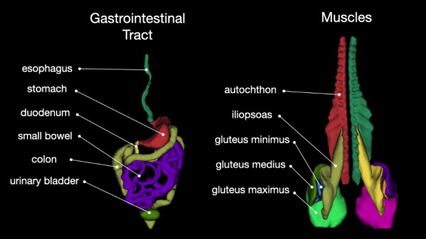 TotalSegmentator provides automatic, easily accessible segmentations of major anatomic structures in CT images buff.ly/472t4h8 <a href="/JakobWasserthal/">Jakob Wasserthal</a> <a href="/MSegeroth/">Martin Segeroth</a> #DeepLearning #MachineLearning #AI