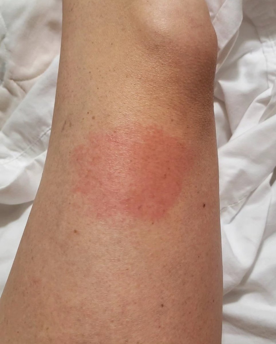 Shanna Johnson tweet media