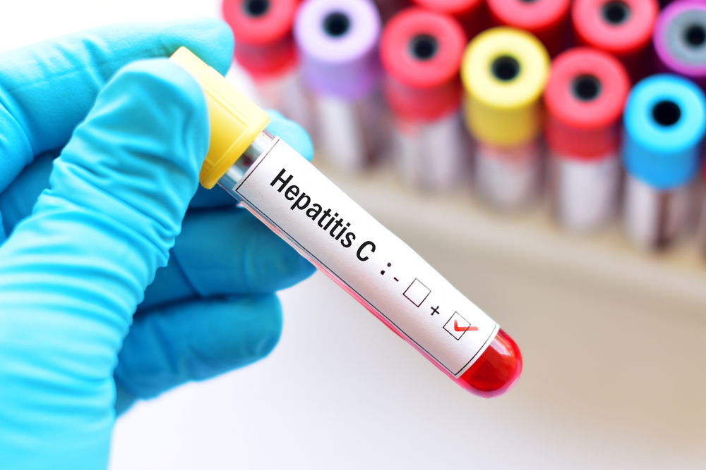 It's #WorldHepatitisDay! In this @Capitol_Weekly piece, members of @giantint & @CAHepatitisC shed light on leveraging pandemic lessons for vaccine development and its vital application in #HepatitisC elimination efforts. 💉 Read more: capitolweekly.net/an-emerging-va…
