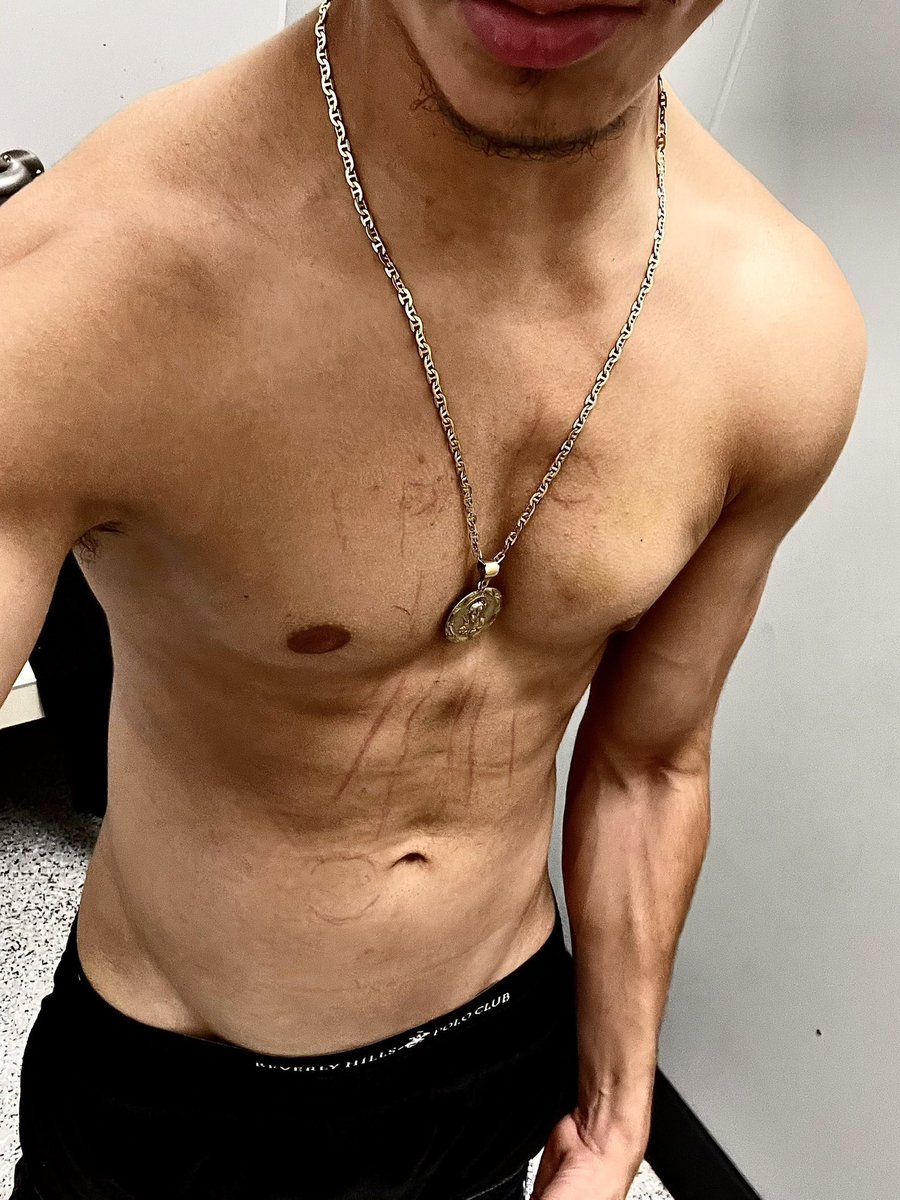 Johnny2Murda's tweet photo. fck or smash? 🙈😫 https://t.co/qMY3rx9i4G