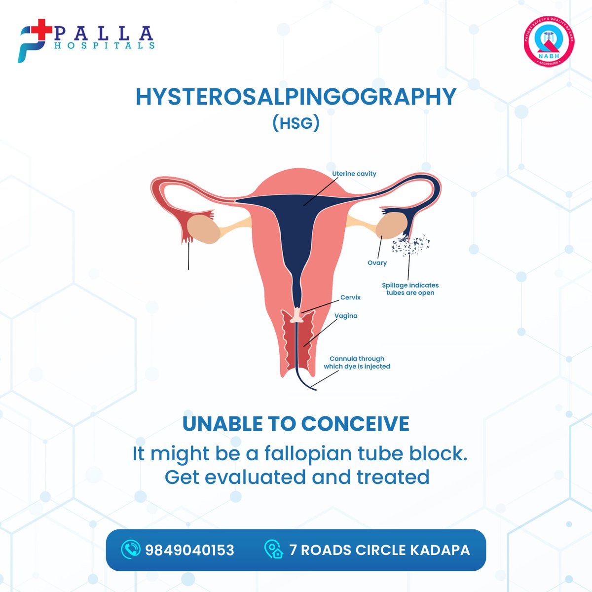 pallahospitals's tweet image. 🌺 Struggling to Conceive? 🌺

💗 Don't worry, you're not alone! 💗

🔍 Hysterosalpingography (HSG) is crucial for evaluation.

🏥 Seek medical help at Palla Hospital for personalized solutions!

#FertilityJourney #HSGTest #ConceptionHope #PallaHospital