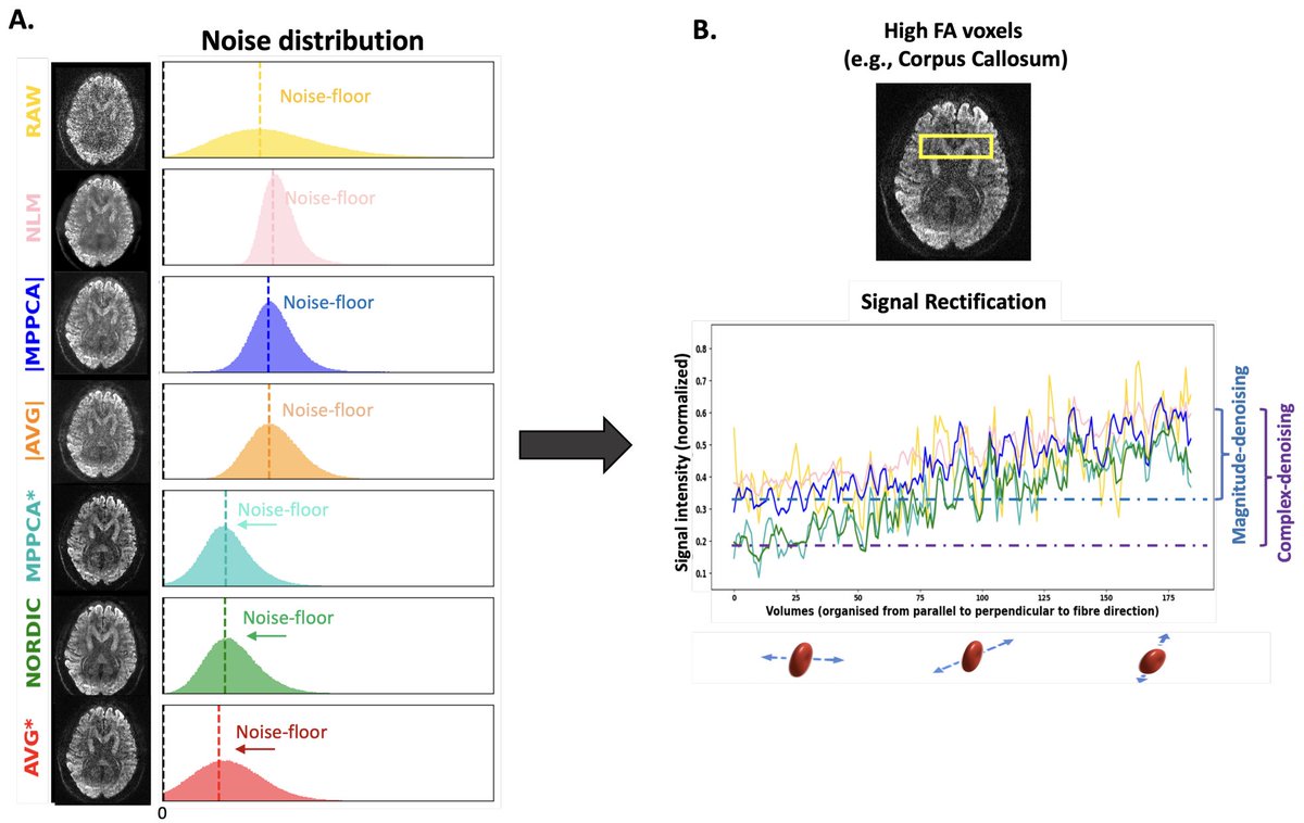 Stam Sotiropoulos (@snsotiropoulos) on Twitter photo Great collaborative work on #denoising diffusion MRI by <a href="/josepemanzano/">J.P. Manzano-Patron</a> with Steen Moeller, Jesper Andersson and Essa Yacoub! We will soon be releasing data as well. #MPPCA #NORDIC <a href="/ERC_Research/">European Research Council (ERC)</a> <a href="/SPMIC_UoN/">SPMIC</a> Great collaborative work on #denoising diffusion MRI by <a href="/josepemanzano/">J.P. Manzano-Patron</a> with Steen Moeller, Jesper Andersson and Essa Yacoub! We will soon be releasing data as well. #MPPCA #NORDIC <a href="/ERC_Research/">European Research Council (ERC)</a> <a href="/SPMIC_UoN/">SPMIC</a>
