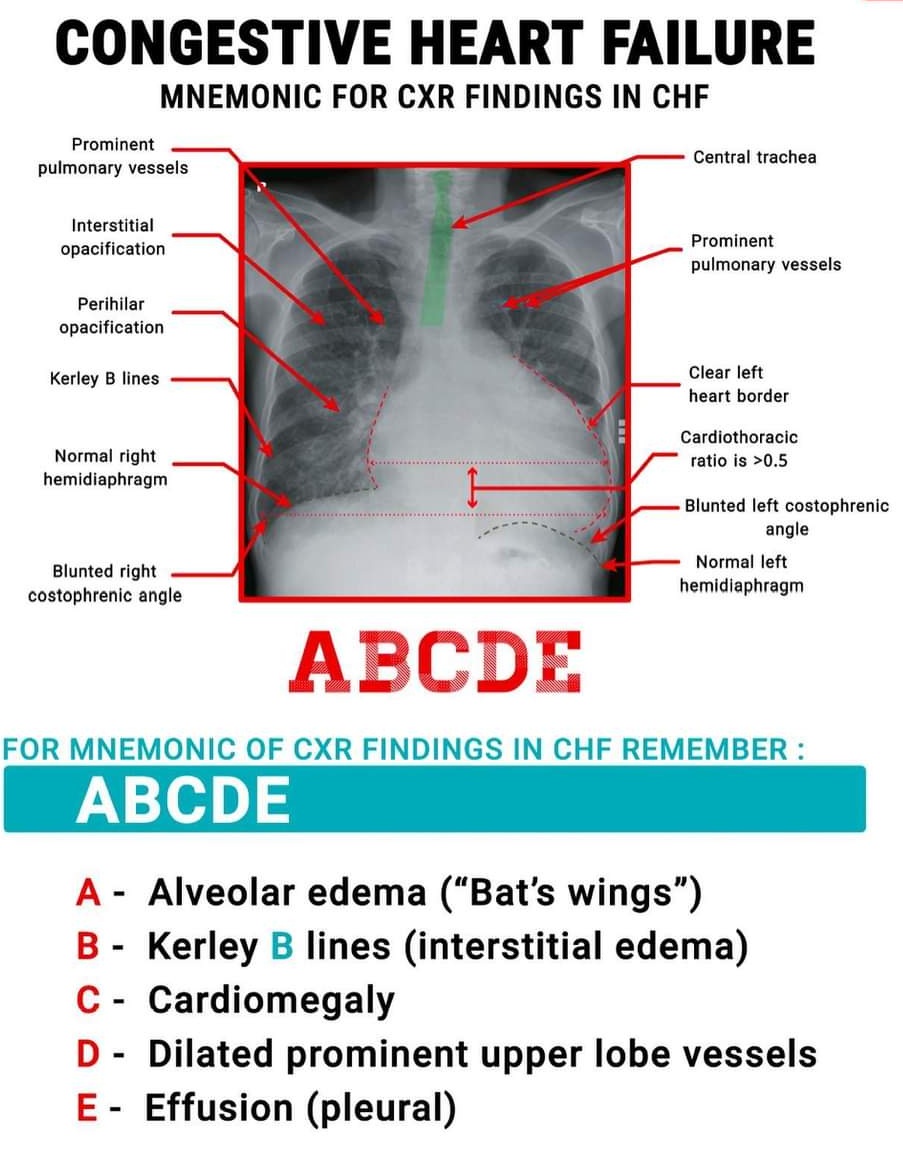 pgMedicine's tweet photo. Watch here 👇

https://t.co/VLmllVS6eU https://t.co/DlgqhzOxKU