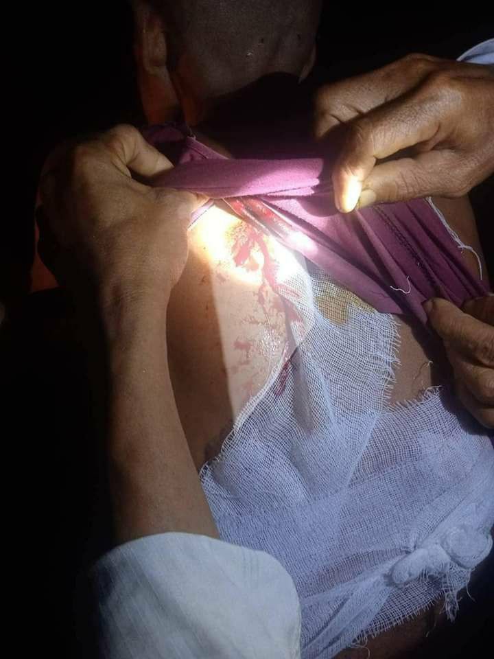 MaybomeM's tweet photo. It is reported that military armed forces shelled artilleries in the villages of Laldo tsp, KNU controlled area on 25th July, so over thousands of local residents from 41 villages had to flee in fear. #2023Jul29Coup #AcceptNUGRejectMilitary #WhatsHappeningInMyanmar https://t.co/XKFG4JOu5c