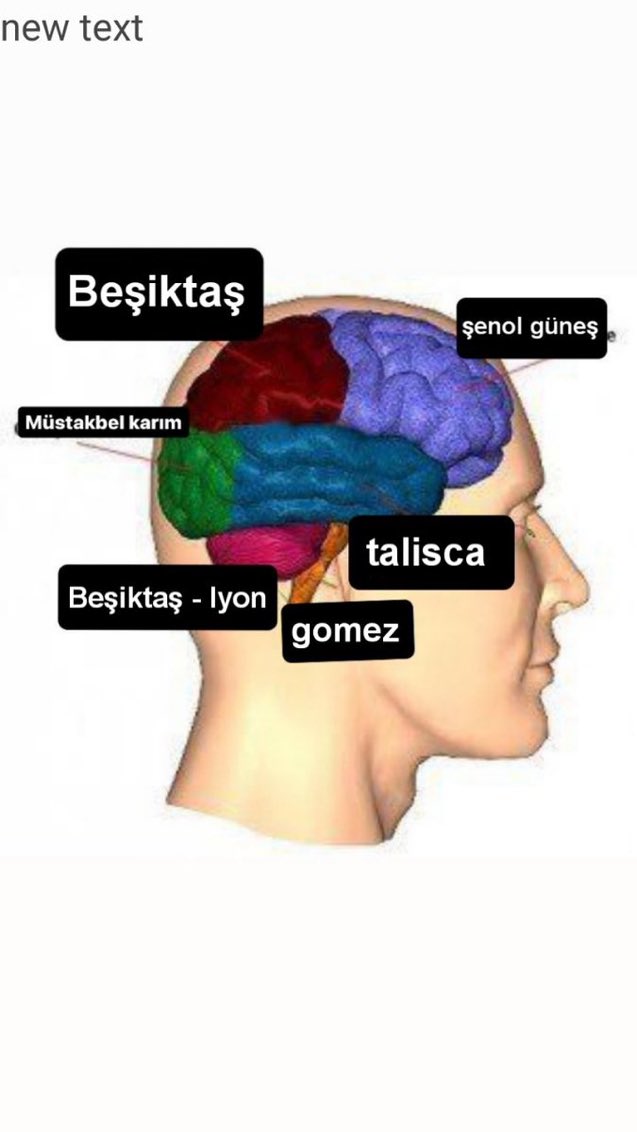 Benim beyin ultrason görüntüsü