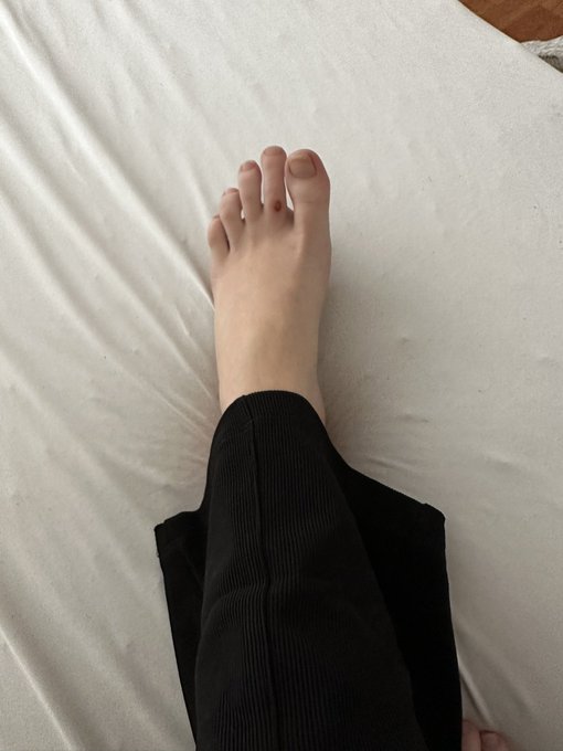 Am I going crazy or is this getting worse instead of better? (Foot ouchie pt.2) https://t.co/8wYxLBK