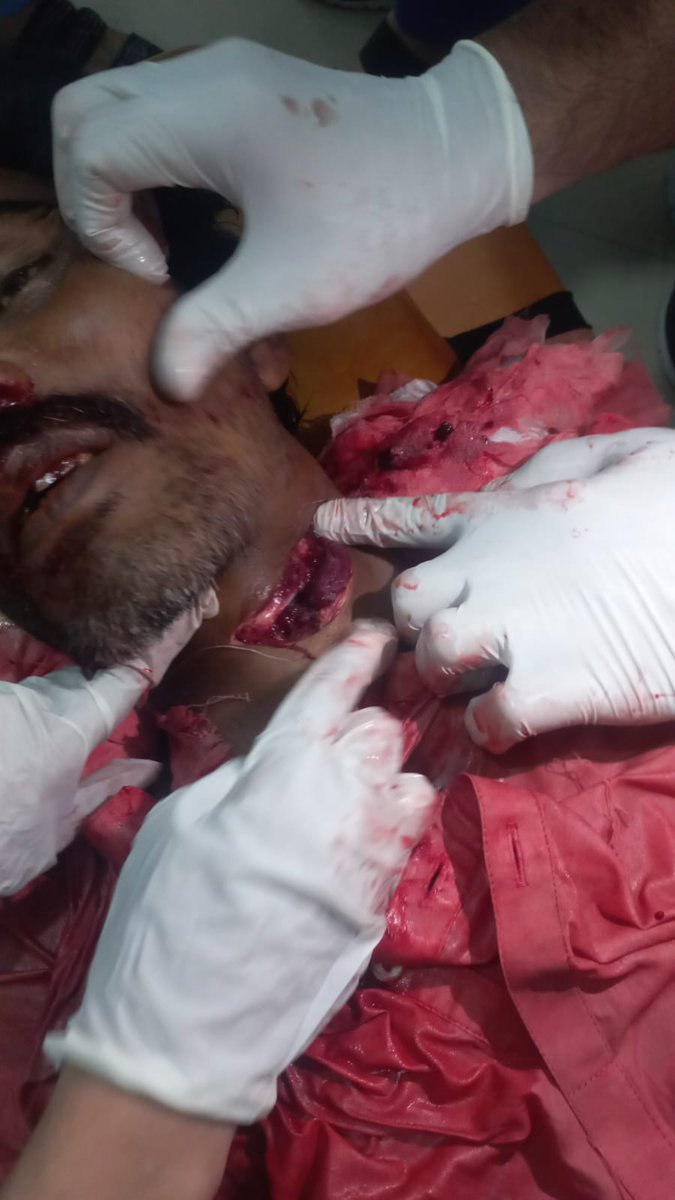 butt_tabish's tweet photo. نعیم علی نامی شخص لاہور ماڈل ٹاون میں زنجیر زنی کرتے ہوئے فوت ہو گیا اللہ اس کے درجات بلند کرے کسی میڈیا چینل نے اس کی خبر نشر نہیں کی۔جناح ہسپتال سے میت ورثا کے حوالے کر دی۔

#شام_غریباں https://t.co/rXC5VvZrBU