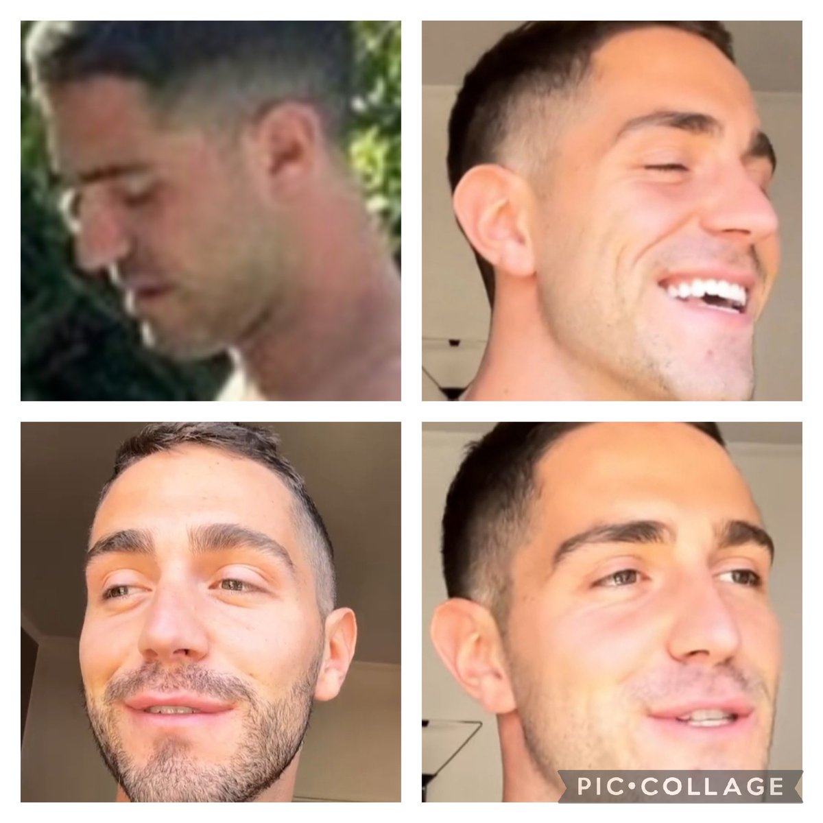 OngariDeanna's tweet photo. Ragazzi mi Γ¨ venuto un dubbio Γ¨ partito rasato dai lati e nella foto che sembra di oggi ,ma con i capelli non ci siamo
Non crescono così velocemente
Che ne pensate.........
#tzvio https://t.co/cFMxbUsOLp