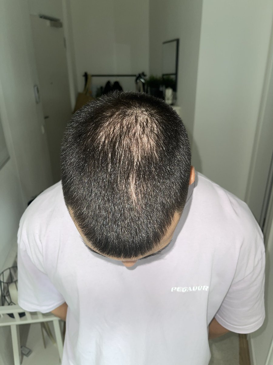 Diät wird frühzeitig abgebrochen wegen mittlerweile mehreren Problemen eins davon ist der starke Haarausfall 
Recovery ist im Gange und off Season wird eingeleitet