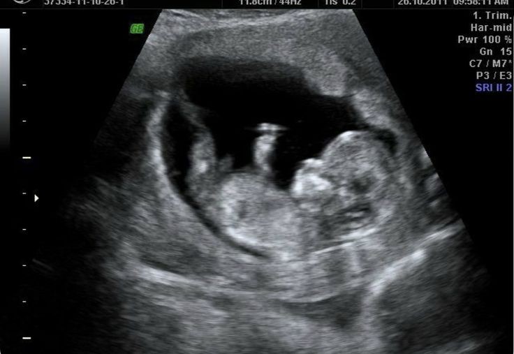 ㅤᅠᅠ 

ᅠᅠᅠᅠ            ㅤᅠᅠㅤᅠᅠ
ᅠㅤㅤㅤSloan-Mikaelson, Babie. ❤️

              {<a href="/DangerMikaelsxn/">𝙹𝙾𝚂𝙷𝚄𝙰 𝙼𝙸𝙺𝙰𝙴𝙻𝚂𝙾𝙽 Ben's Fiance 💍</a> }