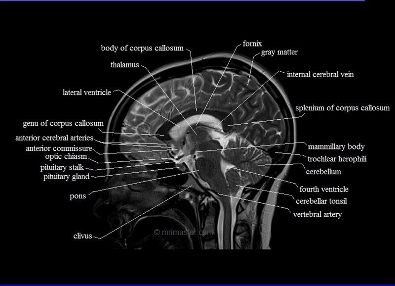 How to read a…

Mid-sagittal anatomy of the human brain “MRI”🧠😍

.