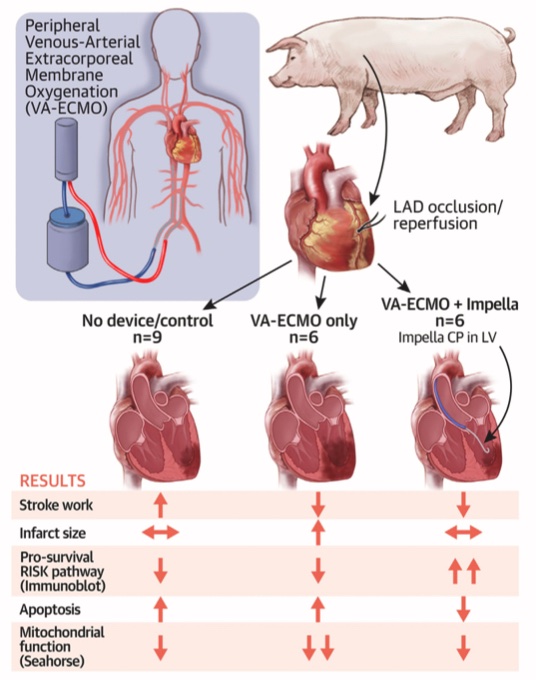 Navin Kapur (@navinkapur4) on Twitter photo <a href="/JACCJournals/">JACC Journals</a> <a href="/KayEverettMDPhD/">Kay Everett, MD, PhD</a> <a href="/lizabiotech/">Lija Swain</a> <a href="/citizenboston/">Lara Reyelt</a> <a href="/Monica_Majumdar/">Monica Majumdar, MD MPH</a> <a href="/BhaveShreyas/">ShreyasBhave</a> <a href="/MTChinMDPhD/">Michael Chin, MD, PhD</a> Here is the correct visual abstract and an excellent accompanying editorial by <a href="/BenediktSchrage/">Benedikt Schrage</a> and <a href="/dirkwestermann/">Dirk Westermann</a> describing translation to the #Unload-ECMO trial
Time to innovate with ECMO
jacc.org/doi/10.1016/j.… <a href="/JACCJournals/">JACC Journals</a> <a href="/KayEverettMDPhD/">Kay Everett, MD, PhD</a> <a href="/lizabiotech/">Lija Swain</a> <a href="/citizenboston/">Lara Reyelt</a> <a href="/Monica_Majumdar/">Monica Majumdar, MD MPH</a> <a href="/BhaveShreyas/">ShreyasBhave</a> <a href="/MTChinMDPhD/">Michael Chin, MD, PhD</a> Here is the correct visual abstract and an excellent accompanying editorial by <a href="/BenediktSchrage/">Benedikt Schrage</a> and <a href="/dirkwestermann/">Dirk Westermann</a> describing translation to the #Unload-ECMO trial
Time to innovate with ECMO
jacc.org/doi/10.1016/j.…