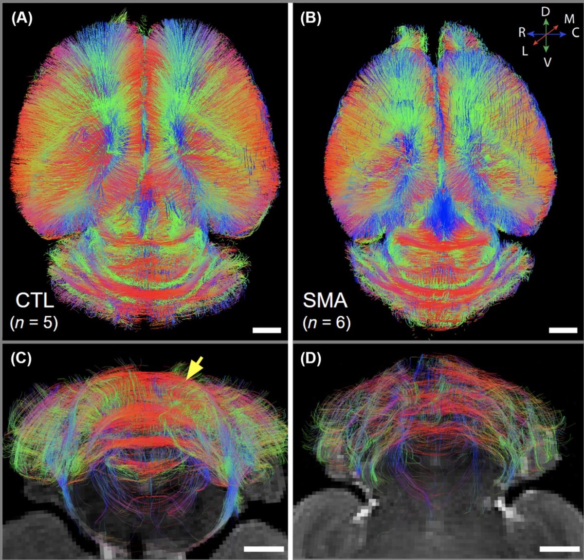 #Scicomm Saturday!!!!  Check this out! ⬇️⬇️

Wow!!!  Look at these #mouse #brain diffusion MR scans produced in collaboration with our own Dr. Charvet, and led by Cottam, and Sun.
