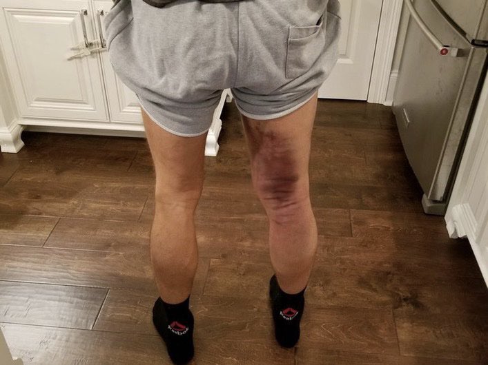 🌴ᴛʜᴇᴀʀᴛᴏꜰᴡᴀʀ🌴 tweet media