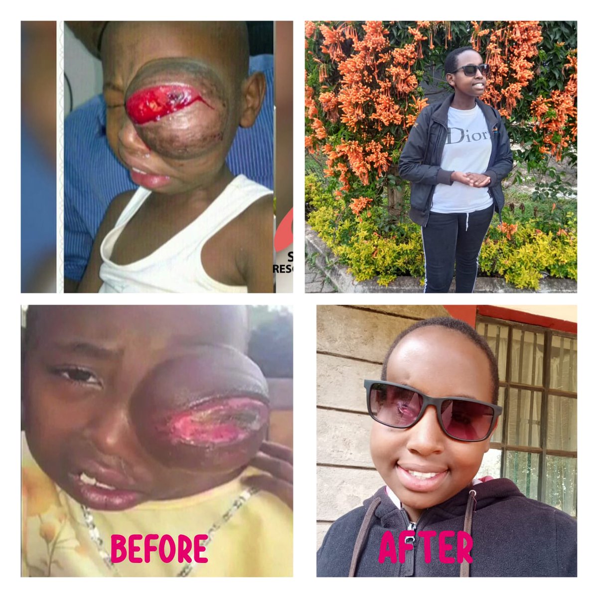 MikeSonko's tweet image. Nimekosa usingizi coz of this sad story of Baby Sagini, who is now homeless in Kisii just a few days after his relatives were jailed for gougling out his eyes. 

Together with other leaders like Hon. Zairee Jihanda, Japhet Nyakundi,  and Hon. Slyvanus Osoro,  among others,…