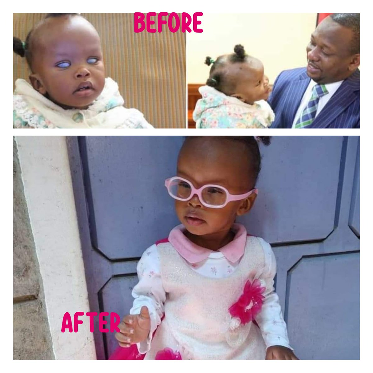 MikeSonko's tweet image. Nimekosa usingizi coz of this sad story of Baby Sagini, who is now homeless in Kisii just a few days after his relatives were jailed for gougling out his eyes. 

Together with other leaders like Hon. Zairee Jihanda, Japhet Nyakundi,  and Hon. Slyvanus Osoro,  among others,…
