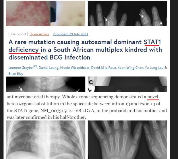 Primary_Immune's tweet photo. 🧬Inborn Error of Immunity ⚠️
.        🆕-ly described "STAT1" mutation
"Two half-siblings presented five years apart, with multifocal osteomyelitis as the dominant feature of disseminated BCG
https://t.co/E0stY27ZNV #raredisease #immunology #genomics
great job @dan_leung_ &amp; Co. https://t.co/MGOqKxUEfx