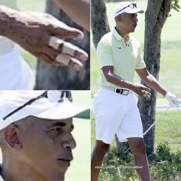 I wonder what happened to Obama’s fingers