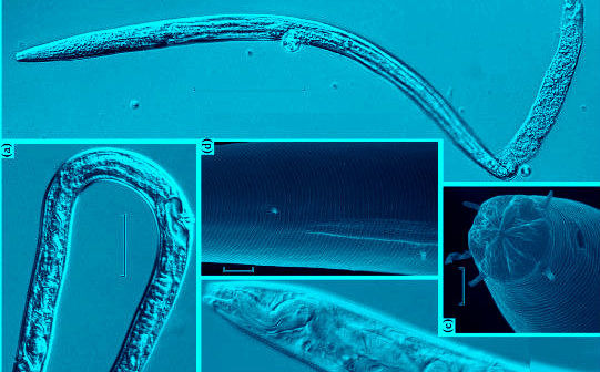 Gabrielasjr's tweet photo. Resucitado un gusano nunca visto tras pasar 46.000 años congelado bajo el hielo en Siberia. La nueva especie devuelta a la vida desde el Pleistoceno puede ayudar a explicar la extraordinaria capacidad de estas criaturas para pasar decenas de miles de años en estado de latencia.

Un equipo internacional de científicos ha conseguido devolver a la vida a un nematodo tras pasar unos 46.000 años, desde el Pleistoceno, congelado bajo el permafrost siberiano. El gusano, que se encontraba a 40 metros bajo la superficie, es una especie nueva para la ciencia.

Algunos animales, como los ultrarresistentes tardígrados (viven sin agua durante décadas y soportan la radiación), los rotíferos (seres multicelulares que solo son visibles al microscopio) y los nematodos, pueden sobrevivir en condiciones adversas al entrar en un estado de latencia conocido como criptobiosis. No es la primera vez que los investigadores recuperan a estas criaturas tras miles de años de congelación. En 2018, por ejemplo, el deshielo del permafrost siberiano permitió la resurrección de unos nematodos de 42.000 años.

En el nuevo estudio, publicado este jueves en 'PLoS Genetics', Anastasia Shatilovich, del Instituto de Problemas Fisicoquímicos y Biológicos en la Ciencia del Suelo RAS en Rusia, logró revivir dos nematodos congelados en una madriguera fosilizada en depósitos de limo en el permafrost. Tras descongelar a los gusanos en laboratorio, un análisis de radiocarbono del material vegetal de la madriguera reveló que estos depósitos intactos, a 40 metros de profundidad, no se habían descongelado desde finales del Pleistoceno, hace entre 45.839 y 47.769 años.

Los investigadores comenzaron a trabajar con los gusanos para intentar conocer qué vías moleculares y metabólicas utilizan estos organismos para permanecer en estado latente y durante cuánto tiempo pueden suspender la vida como 'zombis', algo que no se entiende completamente.

Mediante la secuenciación del genoma, el ensamblaje y el análisis filogenético de la relación del nematodo con las especies modernas, los investigadores determinaron que los gusanos pertenecen a una especie no descrita anteriormente, a la que bautizaron como Panagrolaimus kolymaensis, en reconocimiento a la región del río Kolyma en la que se originó. Al comparar su genoma con el del organismo modelo, Caenorhabditis elegans, identificaron genes comunes que están implicados en la criptobiosis.

Este estudio extiende la criptobiosis más larga descubierta en nematodos en miles de años. Al adaptarse para hacer frente a condiciones extremas, como el permafrost, durante períodos cortos de tiempo, los nematodos podrían haber ganado el potencial de permanecer inactivos durante escalas de tiempo geológicas.

https://t.co/vJhSqTTkKm