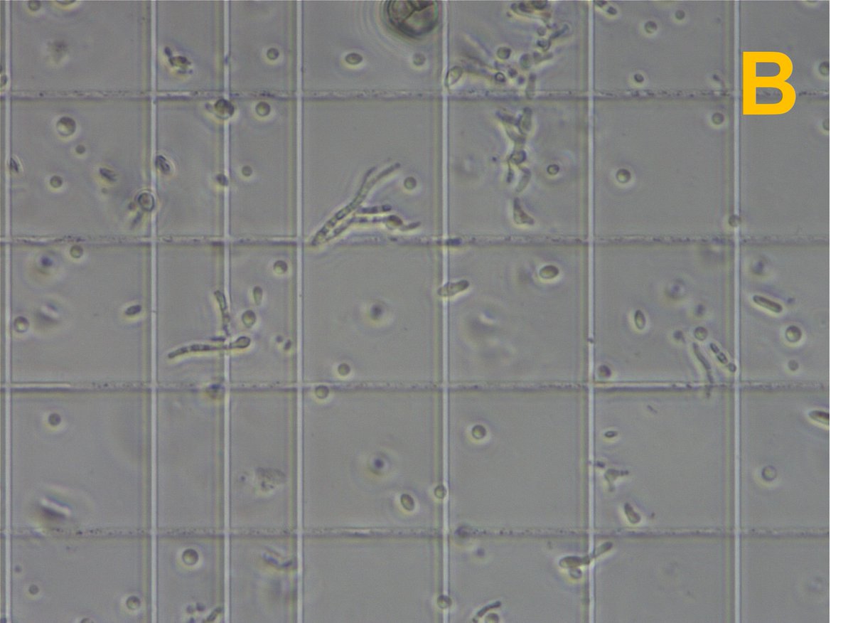 Leca_VIR's tweet photo. The 2 partners (A: virus particles isolated from the donor fungal strain, confirmed by dsRNA extraction, B: proptoplasts prepared from the recipient) are ready, it's time for date (transfection)! https://t.co/73wFwODIDl