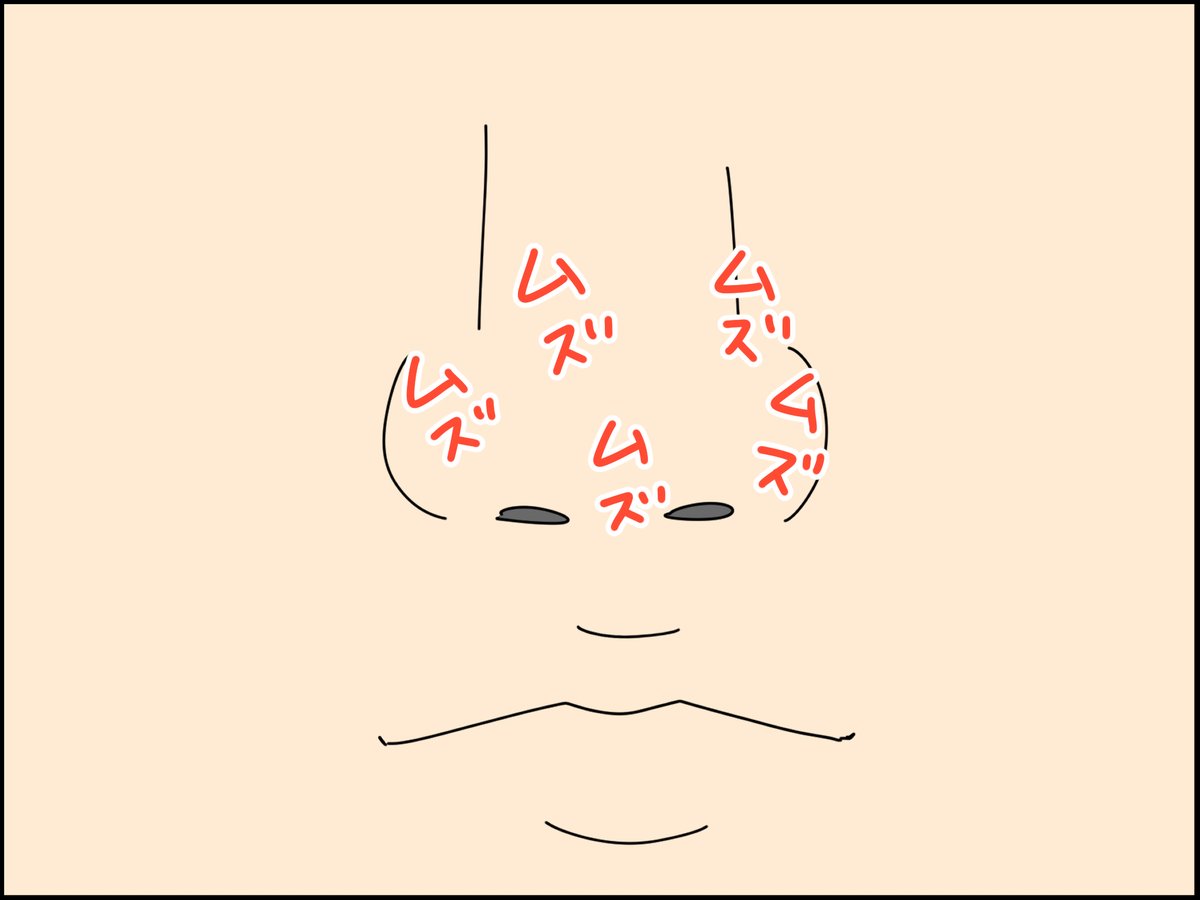 鼻の表面が突然かゆくなるのって何? 2/3 