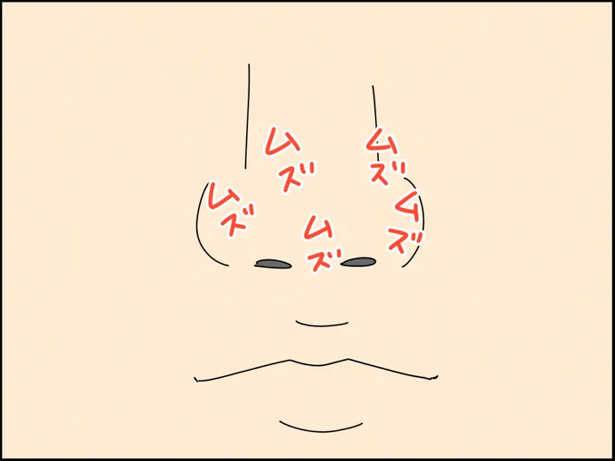 鼻の表面が突然かゆくなるのって何? 2/3 