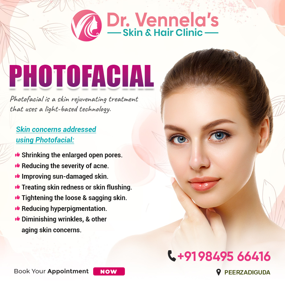 DrVennelas's tweet photo. Reveal Your Radiant Skin with Photofacial! Experience the magic of light-based technology as we address multiple skin concerns and rejuvenate your complexion.
#DrVennelasSkinHairClinic #Photofaccial #OpenPores #DiminishingWrinkles #Technology #AgingSkin #ReducingHyperpigmentation https://t.co/Wwgxjh2zZb