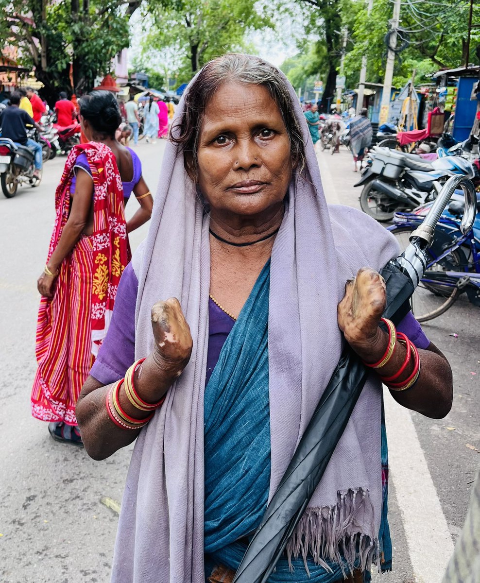 glowohelps's tweet image. Embracing the Rain ☔️

Team Global Western Odisha #GLOWO takes a compassionate step to aid those in need. Our 1st phase of free umbrella distribution at #Balangir has begun, and we&apos;re determined to extend the help across various regions in western Odisha in the days to come. 1/2