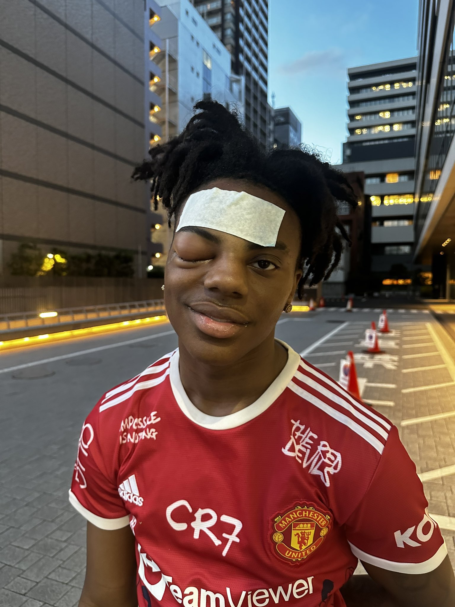 Speedy HQ on X: 🚨 NEW: Speed has been discharged from the Hospital and  is now feeling fine, also the swelling in his eye will go down over the  coming days  /