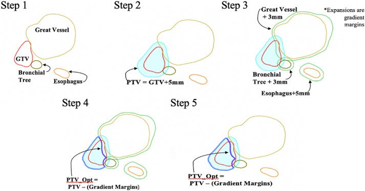 FuenteApolo's tweet photo. The concept of risk adaptation with optimized PTV is increasingly insisted on, and it is logical in these locations.
SBRT #lcsm central, ultracentral  #radonc 
1
https://t.co/ElxJFkKysp ART ETHOS
2
https://t.co/i9pqfgVEgq ART RMlinac.

3 Cyberknife https://t.co/SxEnInUgcG https://t.co/Jc6YlYGKKA