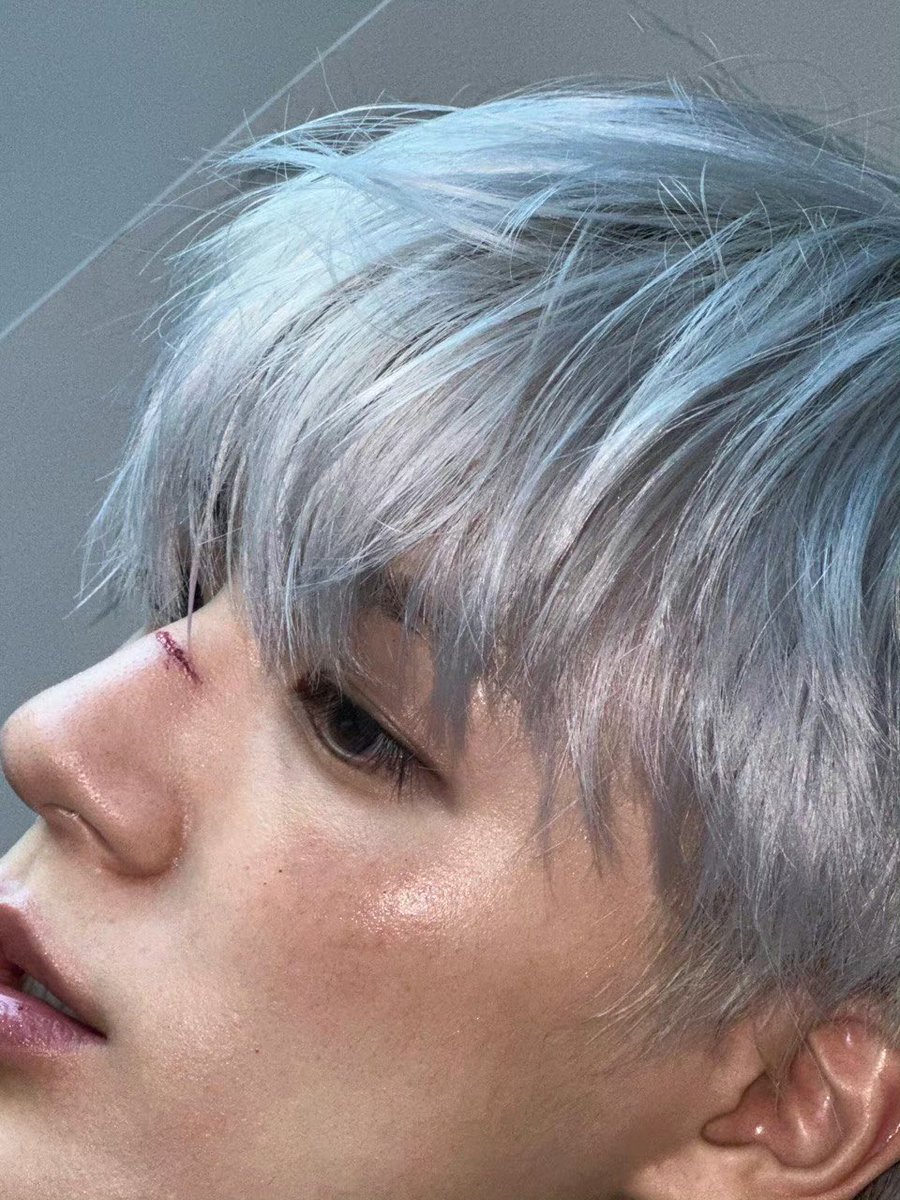 สันจมูกที่ผัว สันจมูกที่กรีดเลือดบาด สันจมูกที่ ㅠㅠㅠㅠㅠㅠㅠㅠㅠㅠㅠㅠㅠㅠㅠㅠㅠㅠㅠㅠㅠㅠㅠㅠㅠㅠㅠㅠㅠㅠㅠㅠㅠㅠㅠㅠㅠ