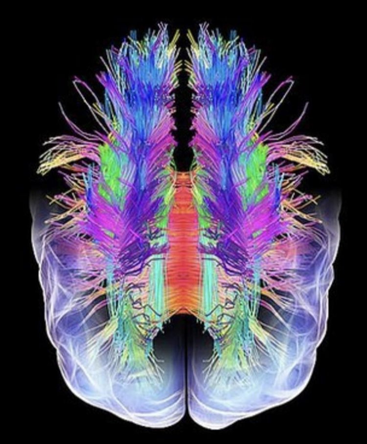 Dan Saladino (@dansaladinouk) on Twitter photo Are the biggest victims of the current food system our brains? 🧠 Join me, <a href="/FoodAndPsych/">Kimberley Wilson CPsychol</a> #MichaelACrawford <a href="/TedDinan/">Timothy Dinan</a> #psychobiotics @FeliceJacka to explore the relationship between what we eat & how we think & feel. <a href="/BBCRadio4/">BBC Radio 4</a> <a href="/BBCFoodProg/">The Food Programme</a> Are the biggest victims of the current food system our brains? 🧠 Join me, <a href="/FoodAndPsych/">Kimberley Wilson CPsychol</a> #MichaelACrawford <a href="/TedDinan/">Timothy Dinan</a> #psychobiotics @FeliceJacka to explore the relationship between what we eat & how we think & feel. <a href="/BBCRadio4/">BBC Radio 4</a> <a href="/BBCFoodProg/">The Food Programme</a>