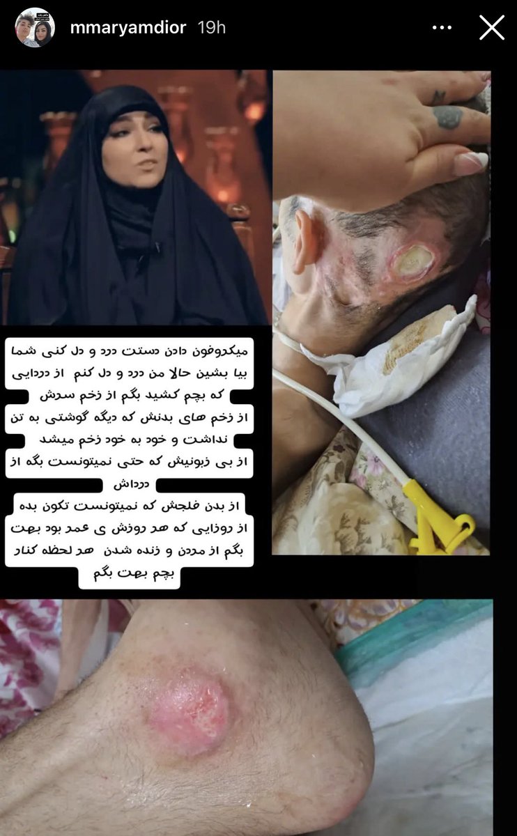 Kamyar2966's tweet photo. استوری مادر #ابولفضل_امیرعطایی https://t.co/7MJynVXAaB