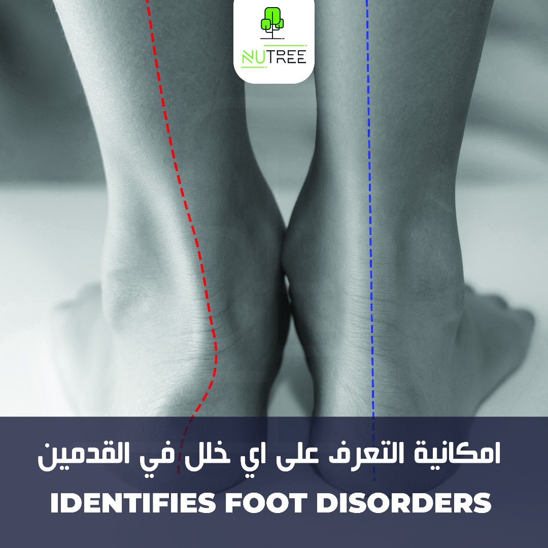 nutreeholisticq's tweet photo. سيساعد برنامج البصمة الخاص بنا في تحديد أي اضطرابات في القدم ووضع خطط تمارين لتصحيحها.​
​
اتصلوا على 44019000​

أو راسلونا على واتساب على 30585858​

#Nutree #footprint #foothealth #walking #dohawalks #doha #qatar #health #wellness #healthandwellness https://t.co/H7XzOzYwcn