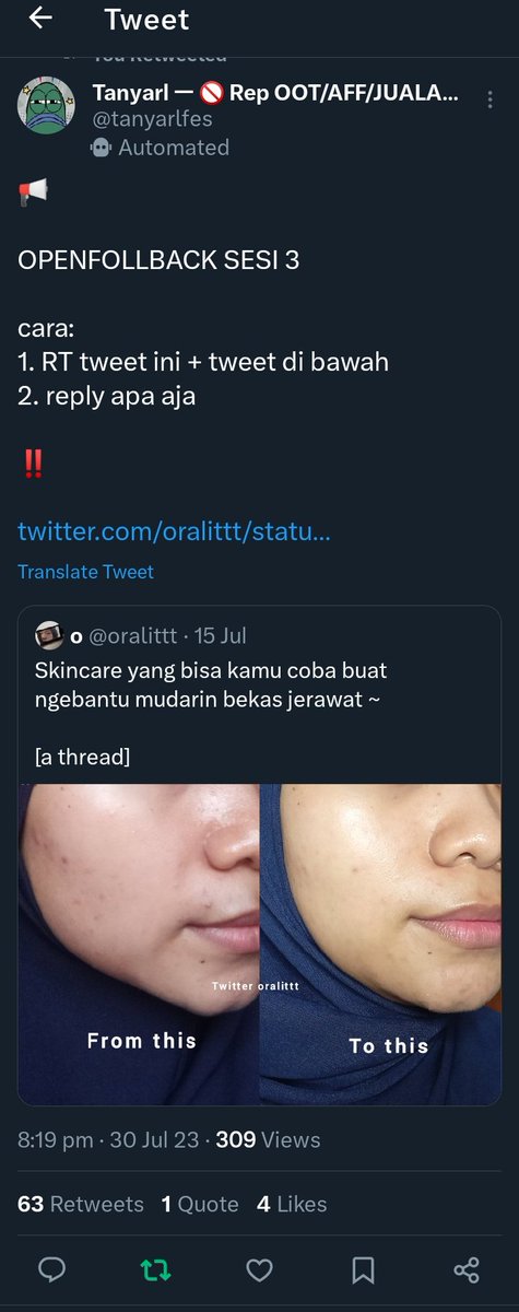 fazanyaa's tweet photo. @tanyarlfes done minn(⁠◠⁠‿⁠◕⁠) https://t.co/K05hZtVyRU