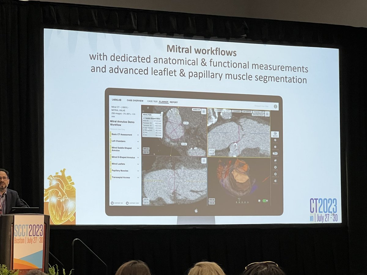 tiffchenMD's tweet photo. Future of #SHDimaging is here: Ronak Rajani showcasing the latest solutions for #LAAO, #TAVR, #TMVR planning at #SCCT2023. Will #AI 🤖 break barriers to complex structural intervention planning? Cost & availability of software are key to ⬆️ procedural safety & accessibility https://t.co/75mN7PkgME