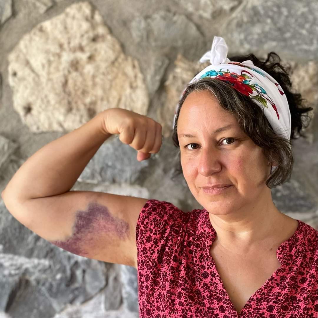 Morarttığınız kollarımızla bu dünyayı ters yüz edeceğiz!

Akbelen Ormanını savunduğu için  Deniz Gümüşel'e yapılan işkencenin hesabını da sanmayın ki sormayacağız! 

Çünkü, we can do it! 💪