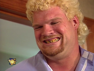OSWreview's tweet photo. Why would a dentist have poor dentition? (Answers in kayfabe please) https://t.co/jaTzXbUsJD