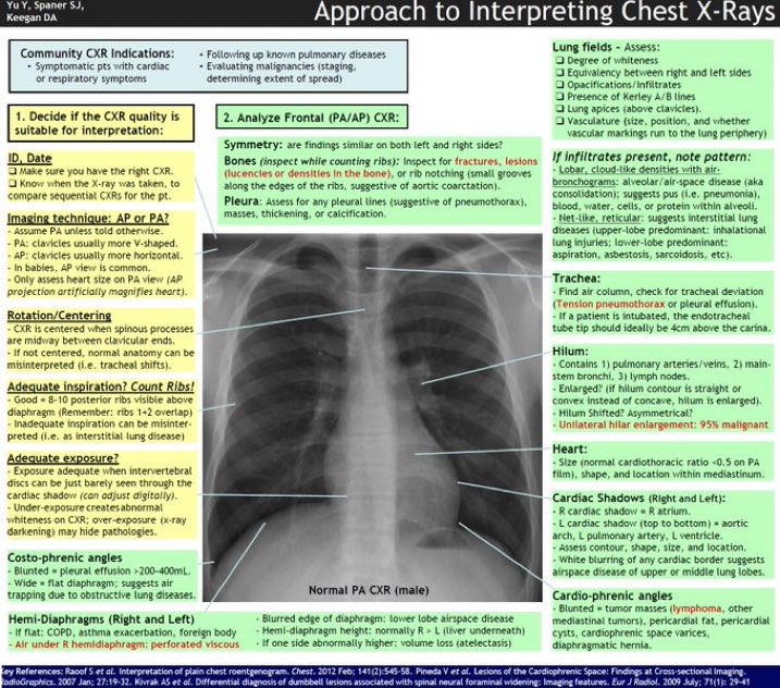DrPharmDMDTh's tweet photo. Chest X-Ray Interpretation https://t.co/YrNMDBYoPA