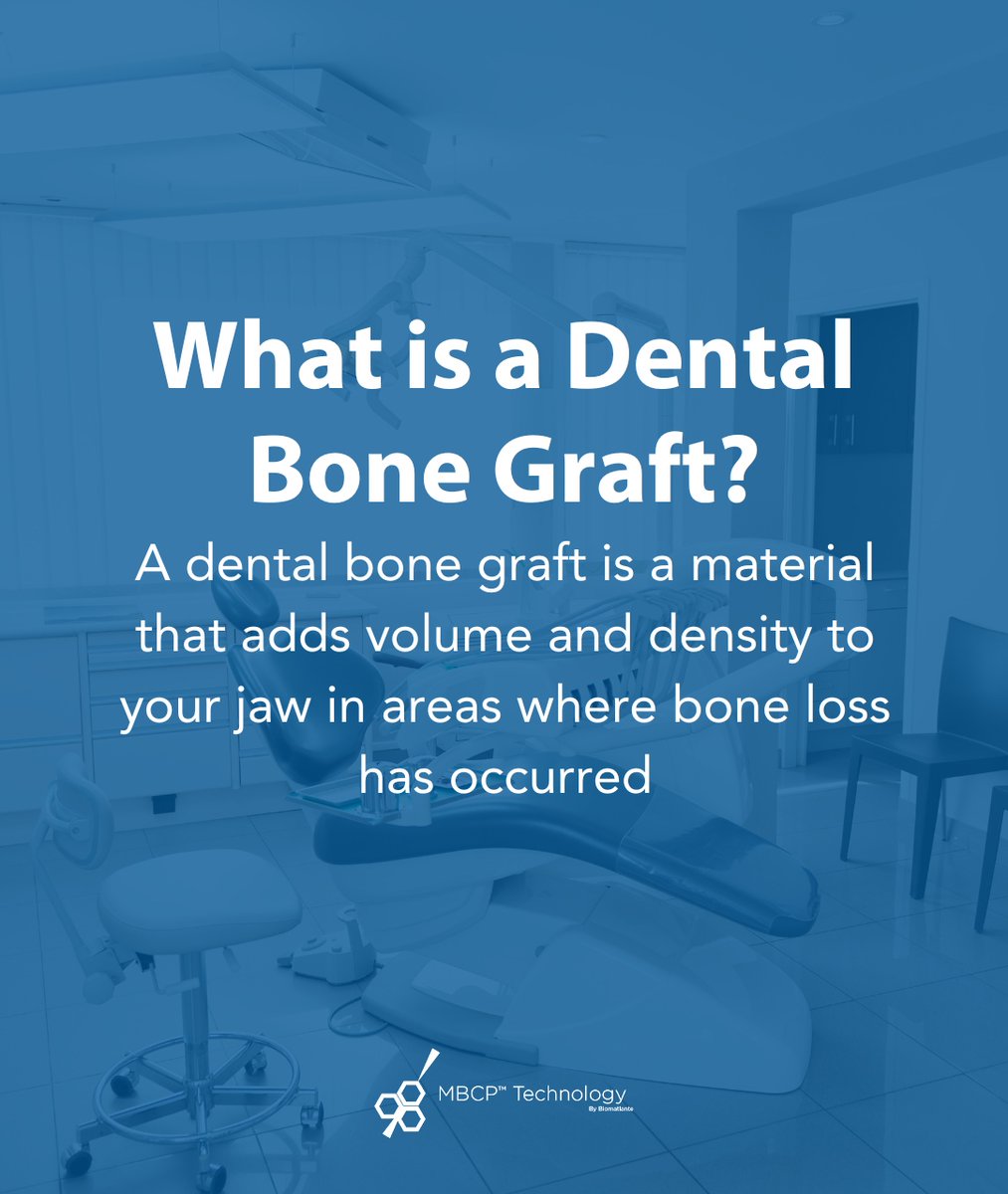 What is a dental #bonegraft?

A dental bone graft is necessary when bone loss has occurred in the jaw. This procedure is commonly performed prior to #dentalimplant placement or when bone loss is negatively affecting neighboring teeth.

Stay tuned for more information.