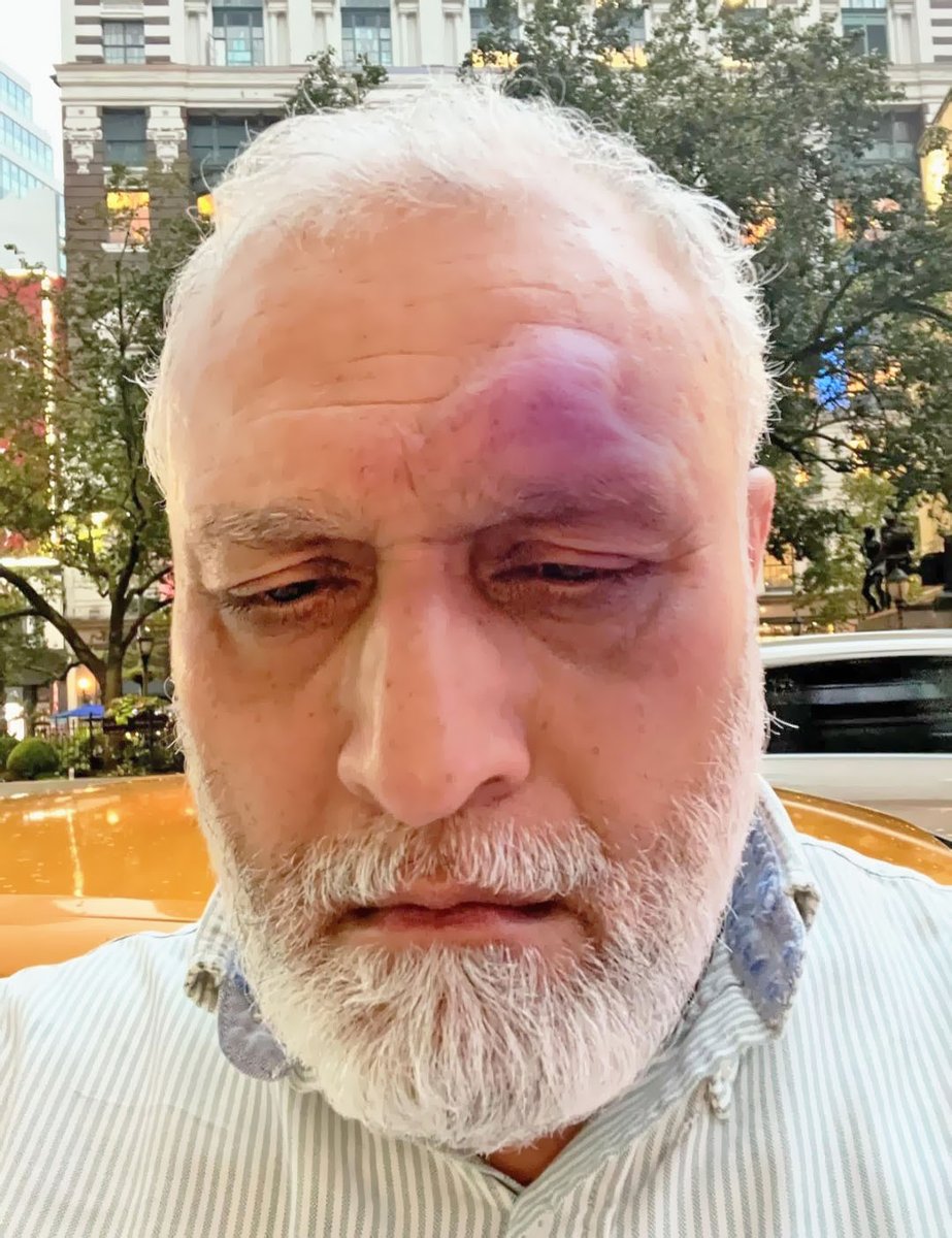 Indusland_'s tweet photo. The victim was Afzal Batt, a 60+ year-old Pakistani cab driver in NYC. Afzal was hospitalized after the incident. This is not the first instance of such attacks happening in NYC, where elderly, hardworking Pakistanis &amp; Asians have been targeted by entitled criminals. https://t.co/H35Us6jPS7