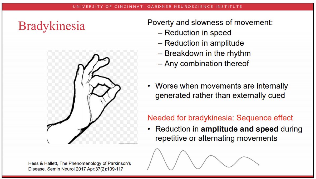 MichaelOkun's tweet photo. No one ever presents to their doc or advanced practice provider and states "I have trouble with my finger taps." @AlbertoEspay  kicks off @movedisorder Aspen course today with an overview of phenomenology of movement and makes the clear point we need to look for 'bradykinesia' and understand how it presents in parkinsonism.