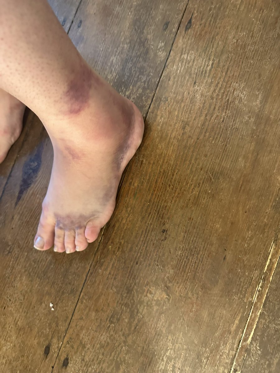 Dear <a href="/lukecombs/">Luke Combs 🎤</a> , not angry but sad to have caught you at Gillette last Friday…in the the monsoon. Bought myself some out-of-character new cowgirl boots. Exited with the masses…in the ridiculous rain. One week post injury…hope to catch ya next time 🤣🤣🤣 #truefan