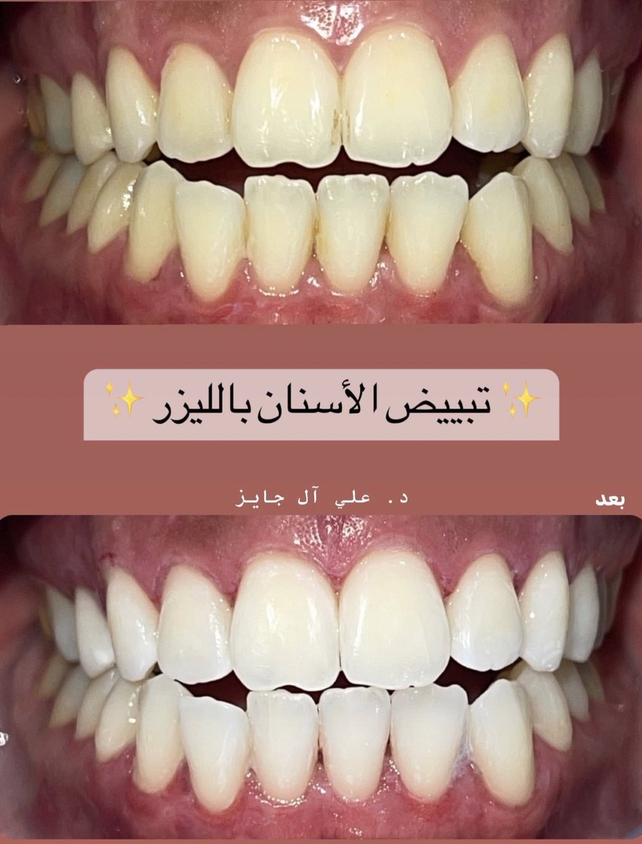 a__jaiz's tweet photo. برّااااااقه ✨✨ https://t.co/JOCqHulU3M
