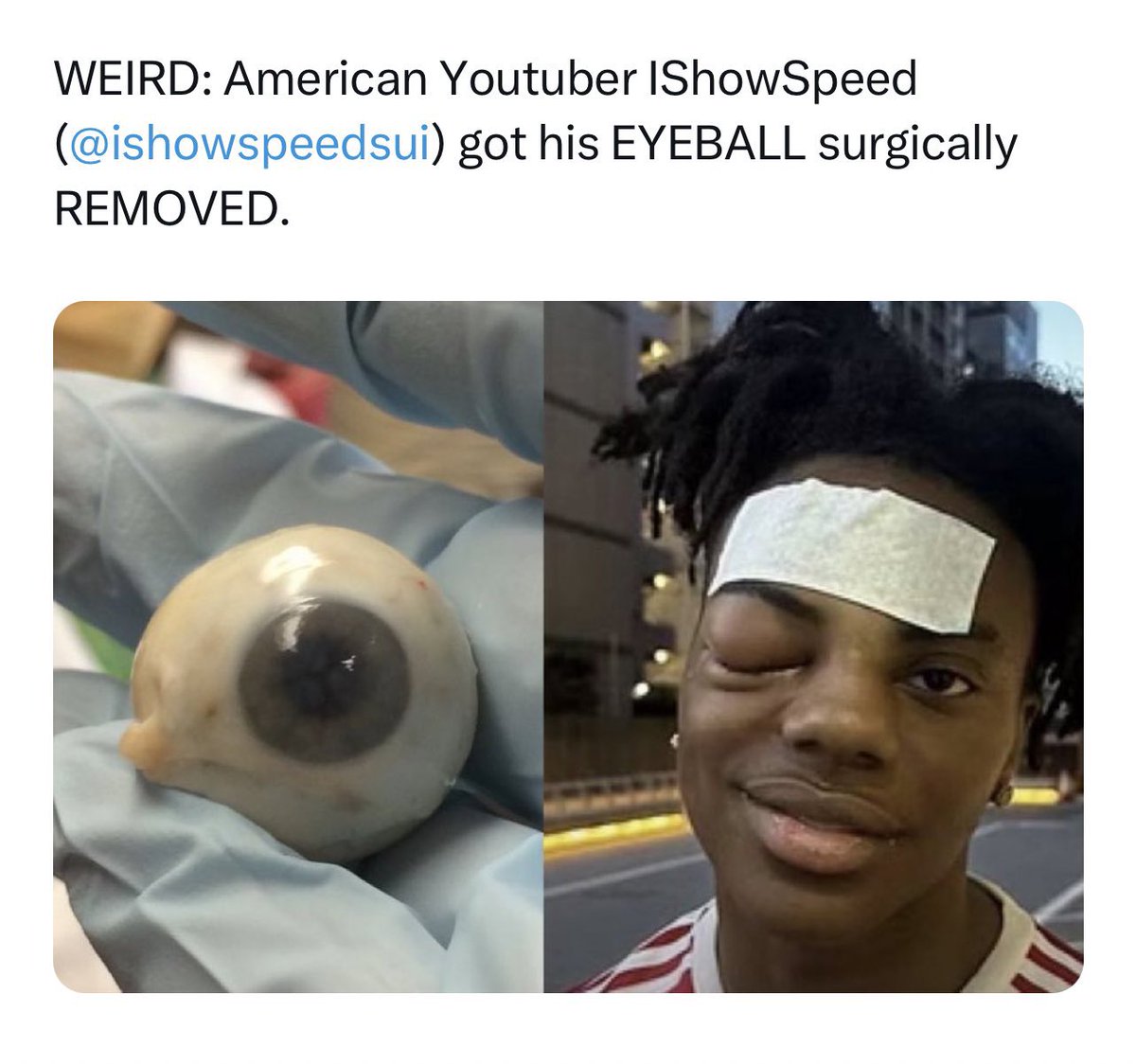 No puedo creer lo qué pasó con <a href="/ishowspeedsui/">Speed⭐️</a> gente pipipi 👁️🤕