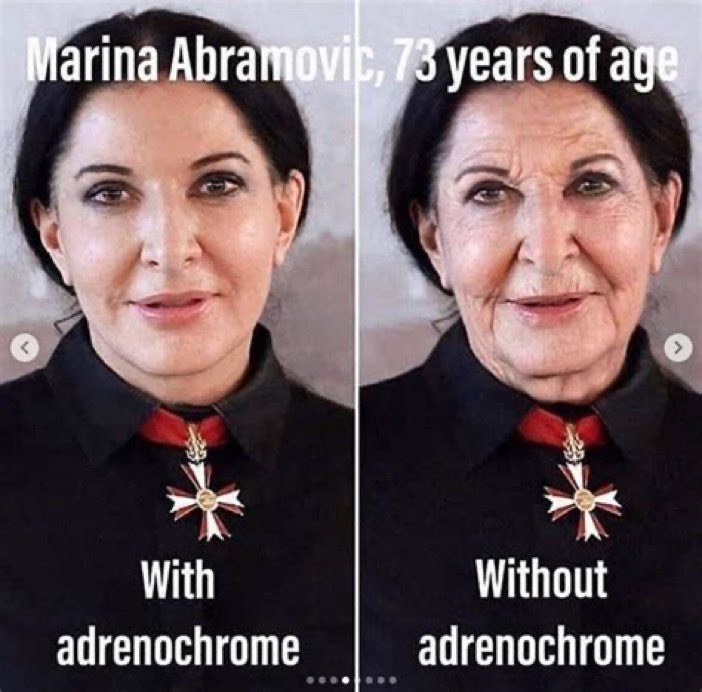 çok dikkatli okumanızı öneririm.
Adrenochrome ELITLERİN GENÇLİK AHLAKSİZLIGI
GENÇLİK iksiri ahlaksızlığı... 
Çocuk derisi değil adrenochrome 

HER YIL GARİBAN ÜLKELERDEN BİRÇOK  ÇOCUKLAR NEDEN KAÇIRILIYOR? !
 İLLÜMİNATİHEP FAAL!!!
ADRENOCHROME NEDİR?
 Çocuk derisi değil enjekte