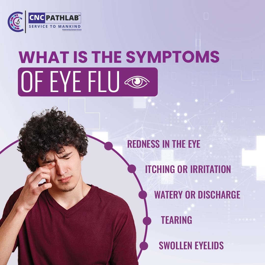 Hey friends! 👋 Dealing with the eye flu is no fun at all, but I'm determined to overcome it like a champ! 😷👊
#EyeFlu #StayHealthy #TakeCare #EyeCareMatters #FluSeason #HealthTips