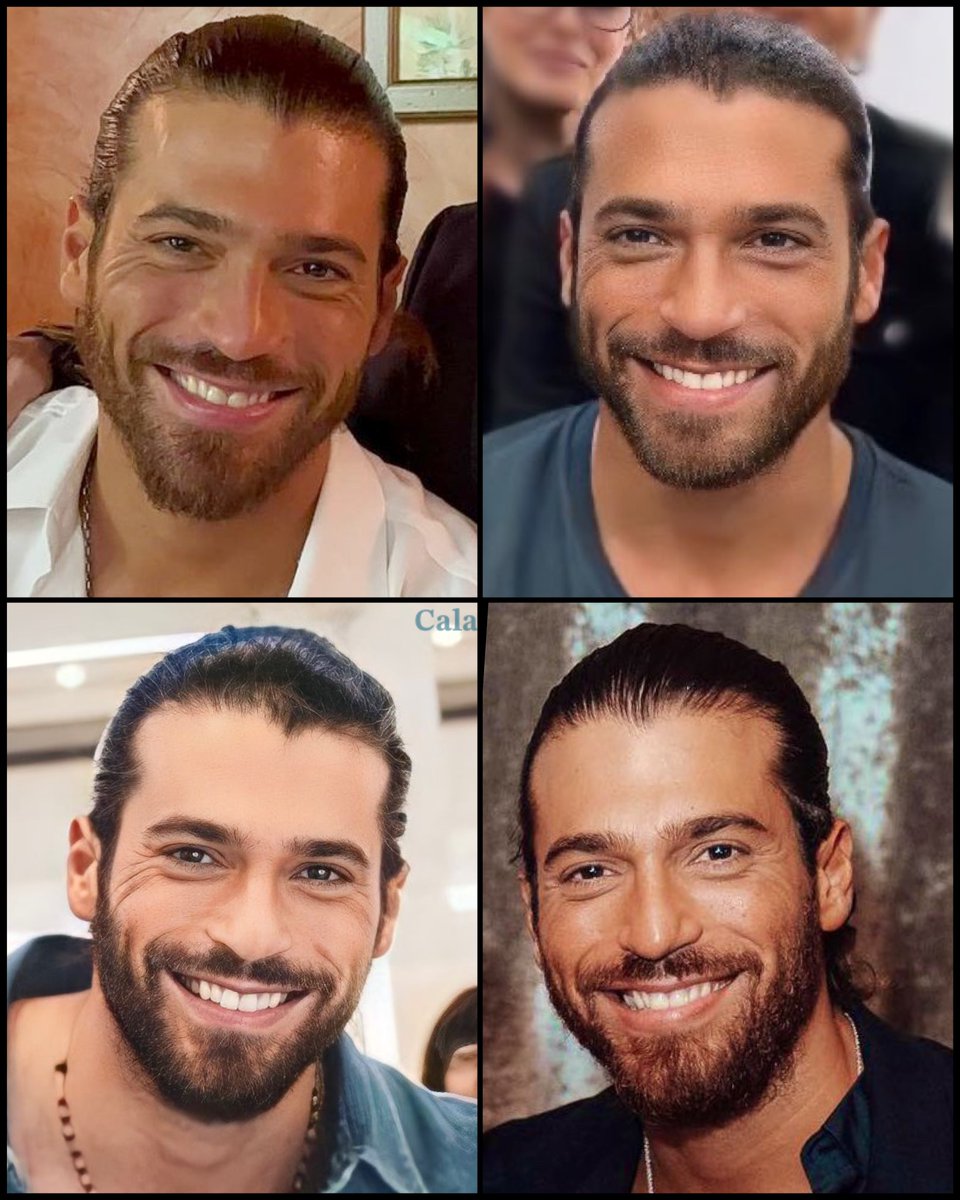 𝑻𝒉𝒆 𝒎𝒐𝒔𝒕 𝒃𝒆𝒂𝒖𝒕𝒊𝒇𝒖𝒍 𝒔𝒎𝒊𝒍𝒆 𝒊𝒏 𝒕𝒉𝒆 𝒘𝒐𝒓𝒍𝒅 🫠🫠🫠
#CanYaman
