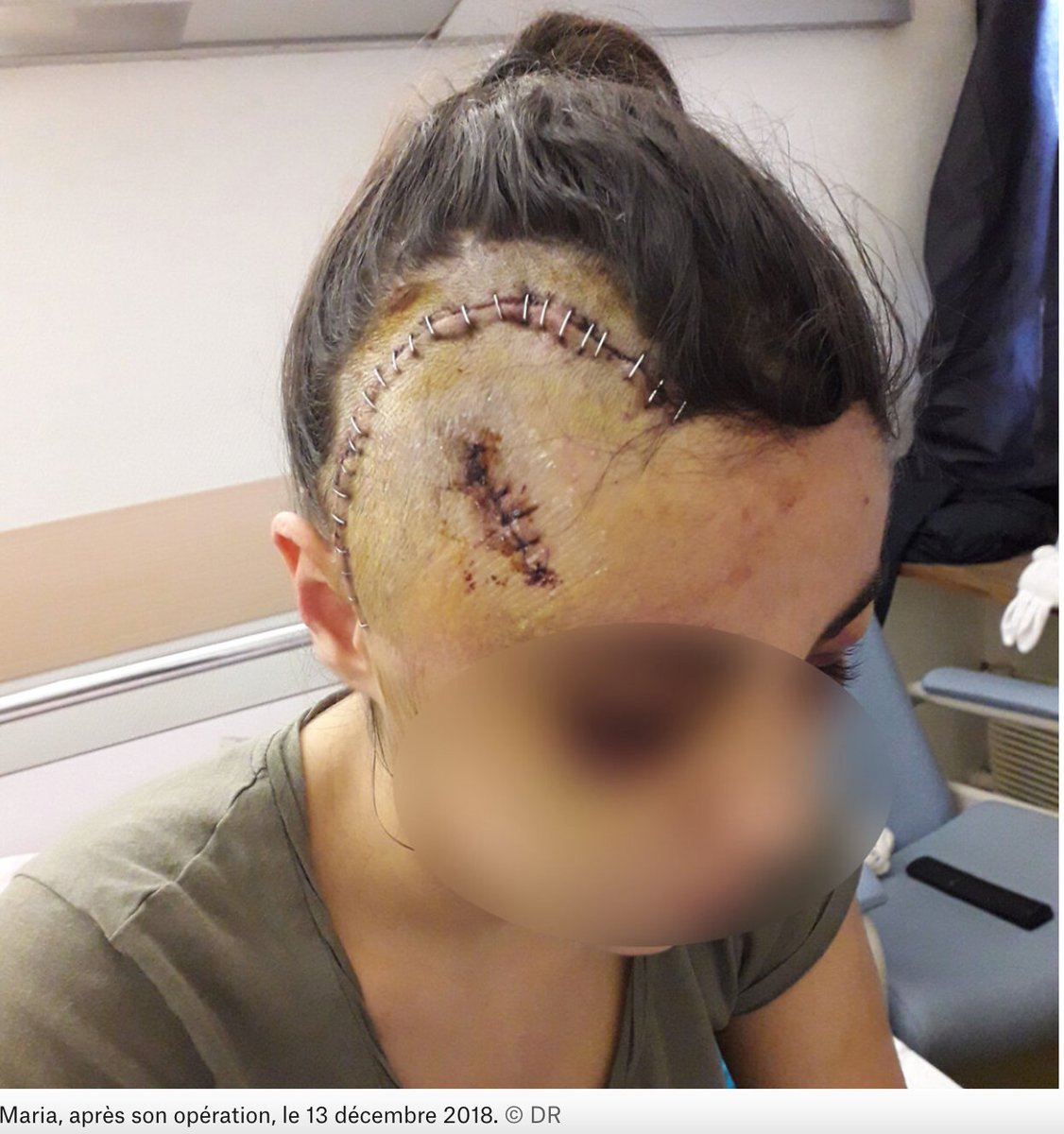 L’un des policiers mis en examen pour violences contre #Hedi à #Marseille est aussi cité dans l’enquête sur le tabassage d’Angelina en 2018. L’agent, qui nie tte implication, était présent dans le périmètre où la jeune femme s’est fait agresser.
mediapart.fr/journal/france… <a href="/Mediapart/">Mediapart</a>