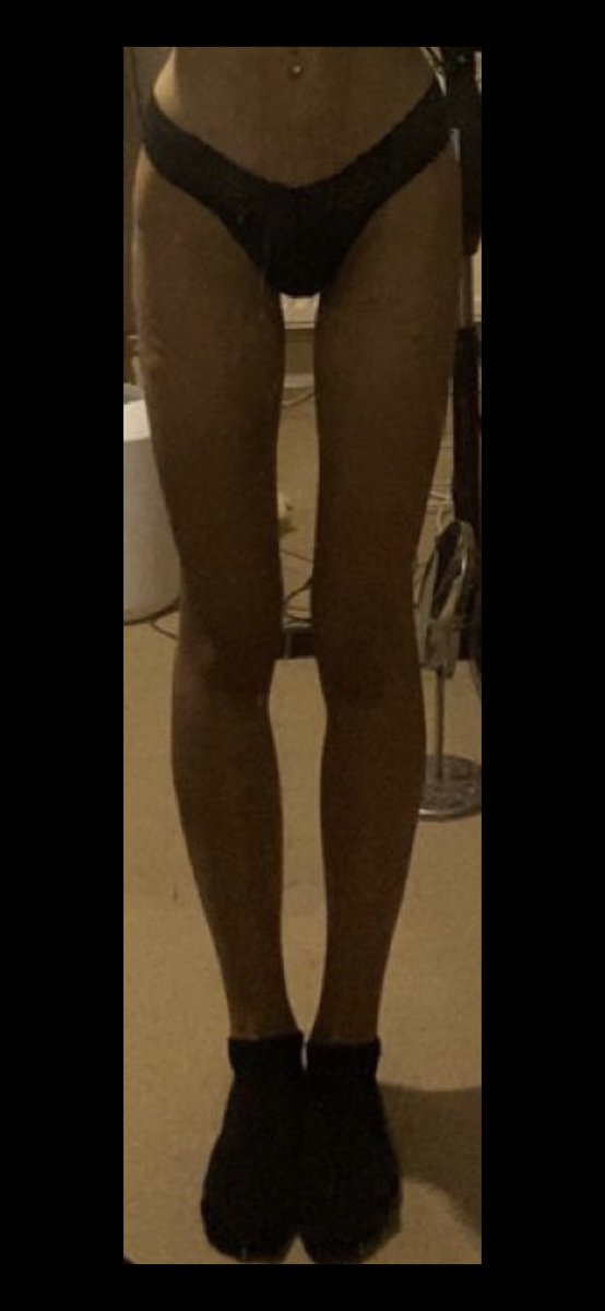 stonarexia's tweet photo. last summer thighs vs this summer👀👀 https://t.co/fokVl7krOY